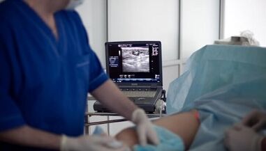 Varicose vein surgery treatment