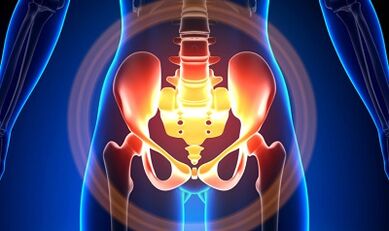 The cause of the pelvic varicose veins