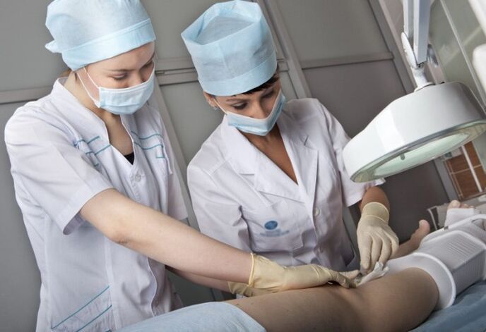 Perform varicose vein surgery on the legs