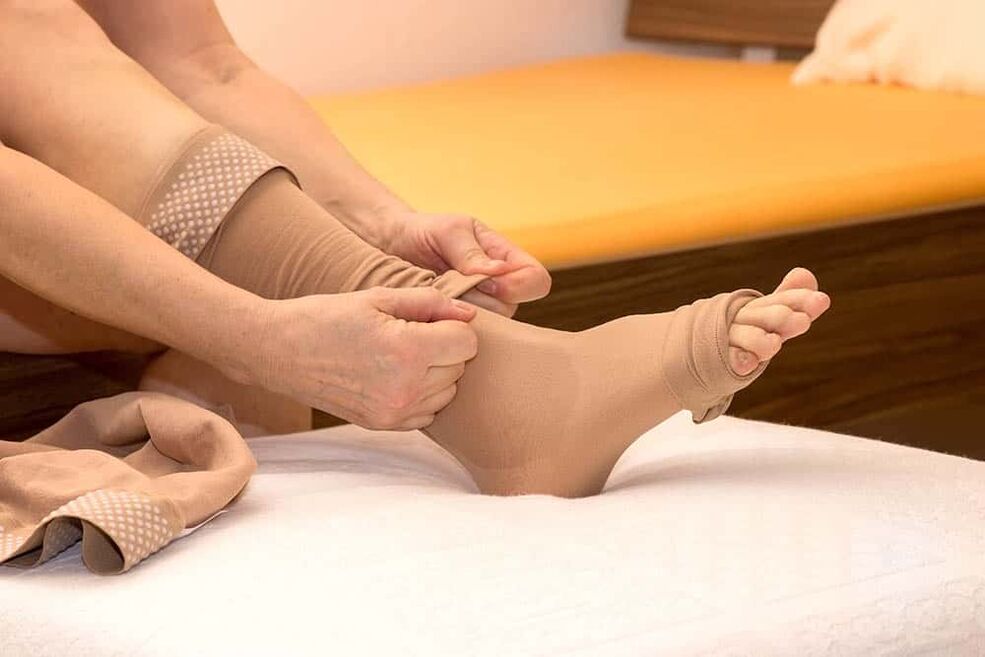 The use of compression stockings will help alleviate the manifestation of varicose veins. 